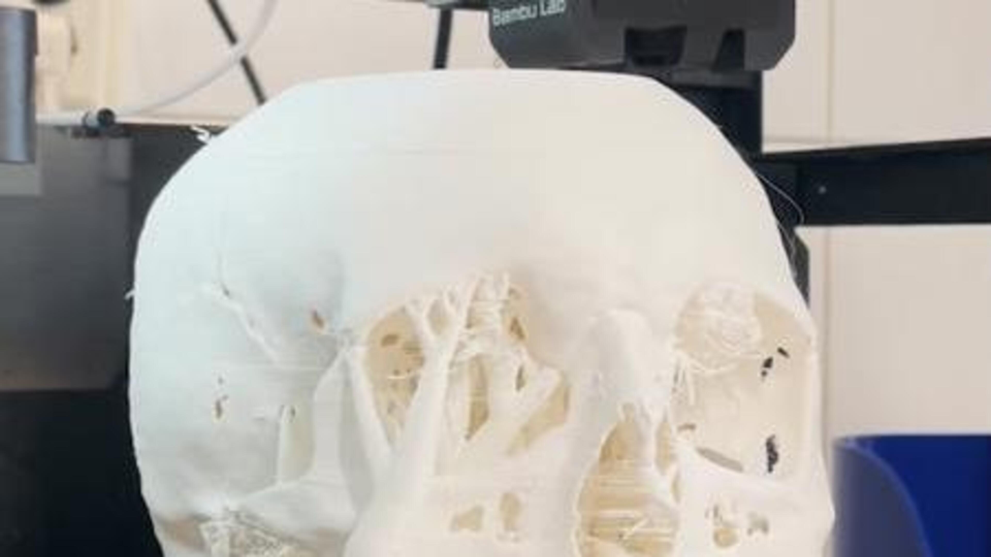 Schedel uit de 3D-printer: koning Zwentibold krijgt na 1100 jaar eindelijk een gezicht